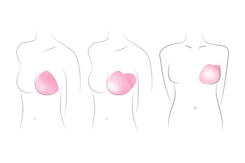 Trulife Recover Shell Breast Prothesis