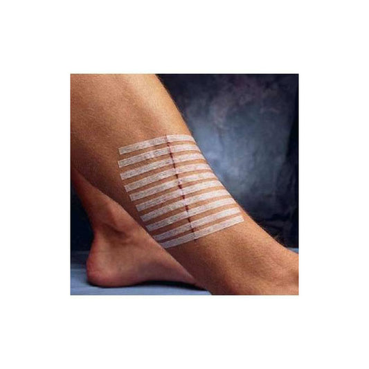 3M™ Steri-Strip™ Reinforced Adhesive Skin Closures